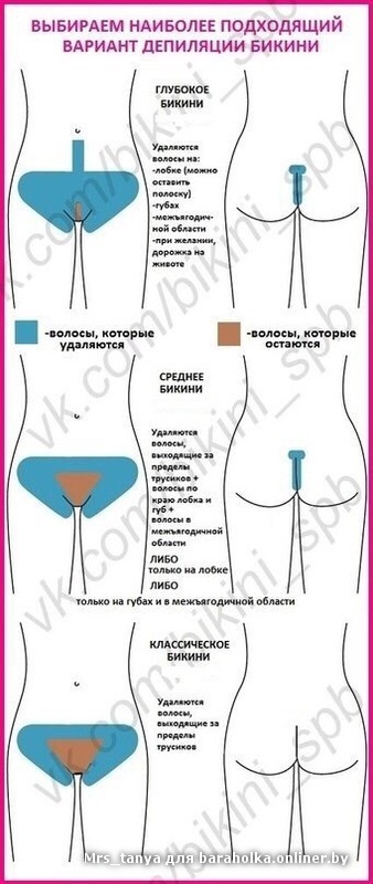 Эпиляция зоны бикини классика это Эпиляция зоны бикини классика это