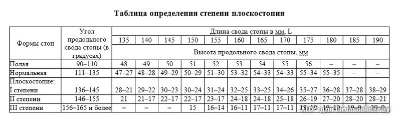 Плоскостопие - причины, симптомы, диагностика и лечение