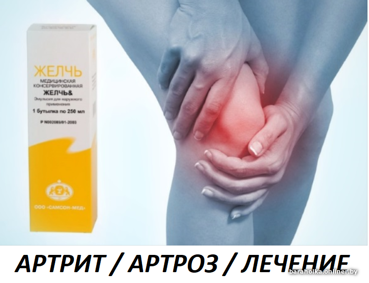 Как использовать медицинскую желчь при болях. Желчь медицинская. желчь медицинская для суставов. компресс из желчи медицинской. компресс с желчью для суставов.
