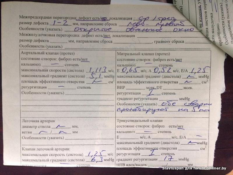 Пролапс митрального клапана с регургитацией 2. Пролапс митрального клапана УЗИ протокол. ПМК 1 степени с регургитацией. Степени регургитации УЗИ.