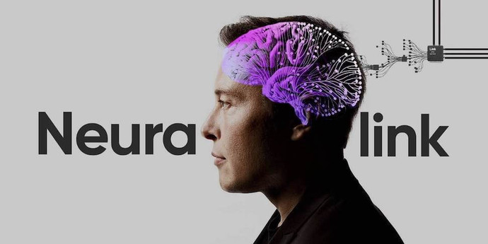 Neuralink イーロン・マスク氏、2人目の患者の脳にインプラントを埋め込むことに成功