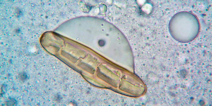 これまで知られていなかったクラスの「生物学的実体」が人体で発見された