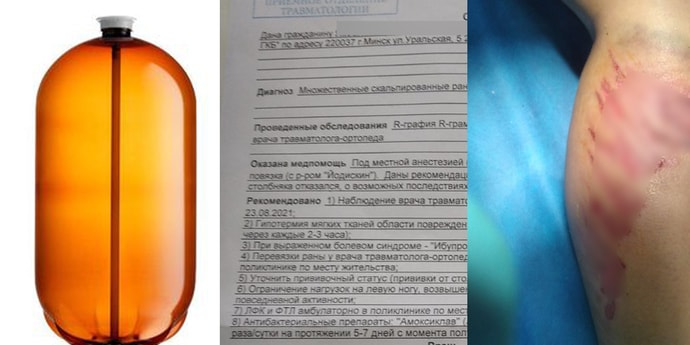 Дети играли с пластиковым кегом, а тот взорвался. Ребенка увезли на скорой
