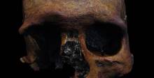 В черепе жившего более 1,6 тысячи лет назад мужчины нашли следы менингиомы